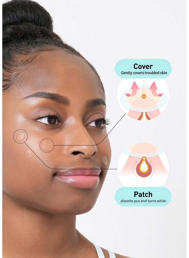 Care Plus Spot Patch 2 Pack Hydrocolloid Acne Korean Spot Patch To Cover Zits Pimples And Blemishes For Troubled Skin And Face (204 Count 10Mm*144Ea + 12Mm*60Ea)