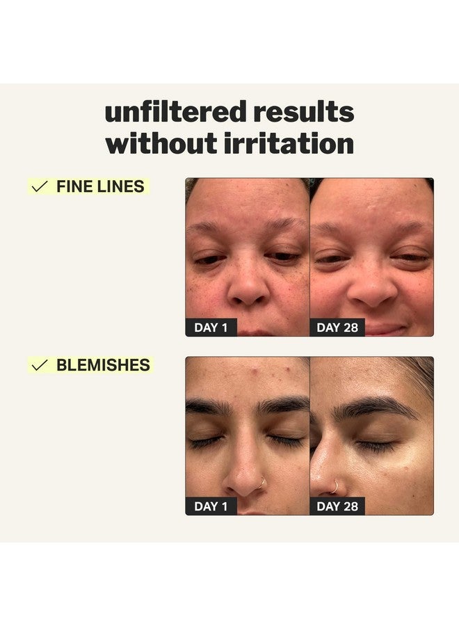 Beginner Retinol Gel 0.1% Improve The Appearance Of Fine Lines And Uneven Texture Without Irritation Aloe And Cica To Prevent Dryness 1 Fl Oz