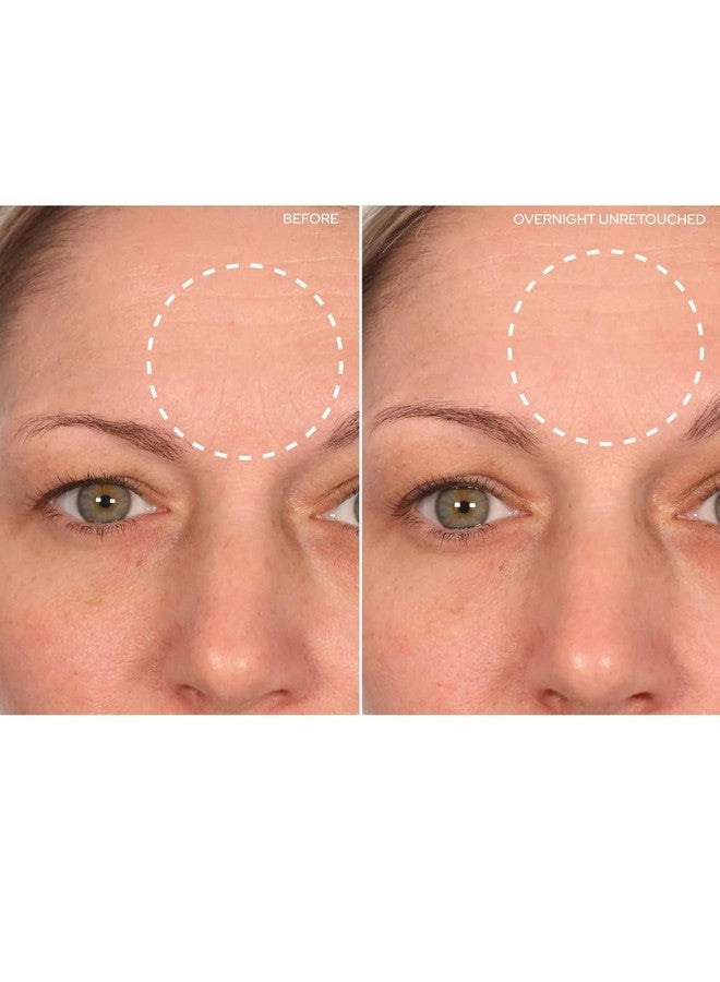 Sio Beauty Browlift Forehead Antiwrinkle Patch Rapid Overnight Reusable Silicone Patch To Reduce Furrows Expression Lines And Creases