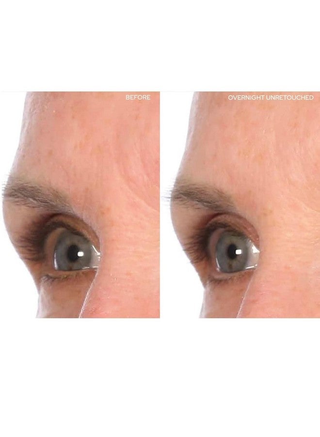 Sio Beauty Browlift Forehead Antiwrinkle Patch Rapid Overnight Reusable Silicone Patch To Reduce Furrows Expression Lines And Creases