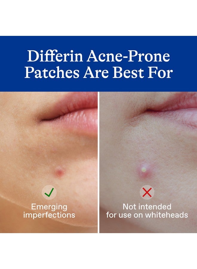 Acneprone Skin Patches For Earlystage Imperfections Formulated With Salicylic Acid And Centella Fast Triple Action Power Patch For Day & Night Dermatologist Tested 36 Count