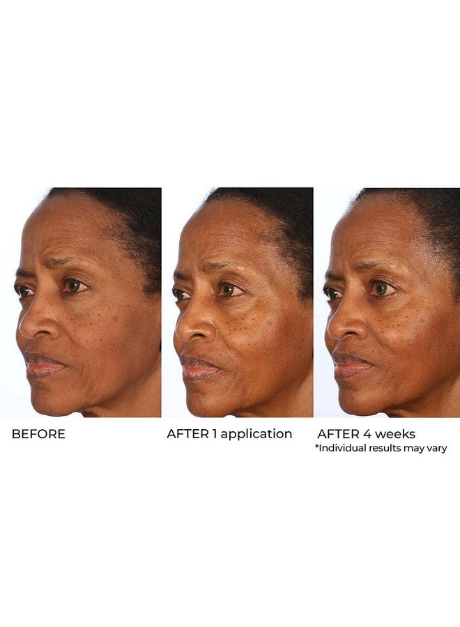 Nassifmd® Radiance Booster Vitamins C For Face Brightening Serum Dark Spot Remover Vitamin C With Omega3 And Squalene Oil