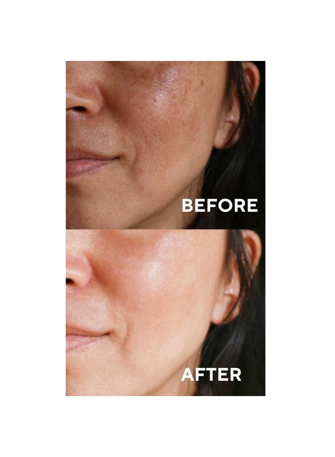 Vitamin C Face Serum Brightening Moisturizing And Anti Aging Serum For Dark Spots Wrinkles Vitamin C Serum For Face With 20% Pure Vitamin C Ferulic Acid And Vitamin B5 1.Fl.Oz(30 Ml)