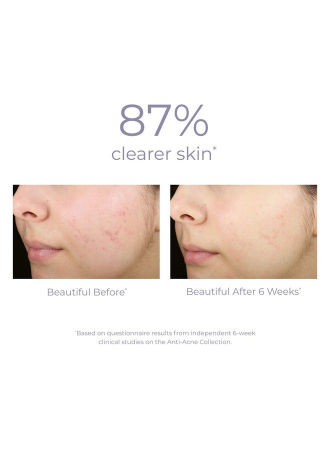 Acne Blemish Control Treatment Serum