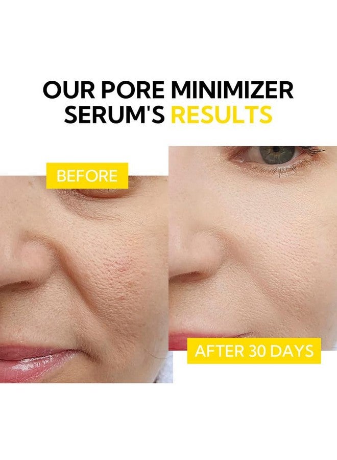 Pore Minimizer Serum Pore Minimizer & Reducer For Face Minimizing Shrinking Oil Control Firming Tightening Pores 100% Vegan Pore Moisture After Blackhead Remover 0.5 Fl.Oz