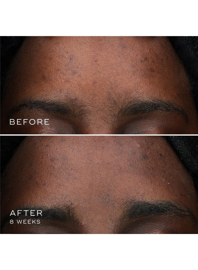 Oxyr Peptides Serum Targeted Dark Spot Corrector With Twin Peptides Freshly Activated Brigthening Serum For Face Evens Skin Tone And Discoloration Gentle On Sensitive Skin 0.3 Oz