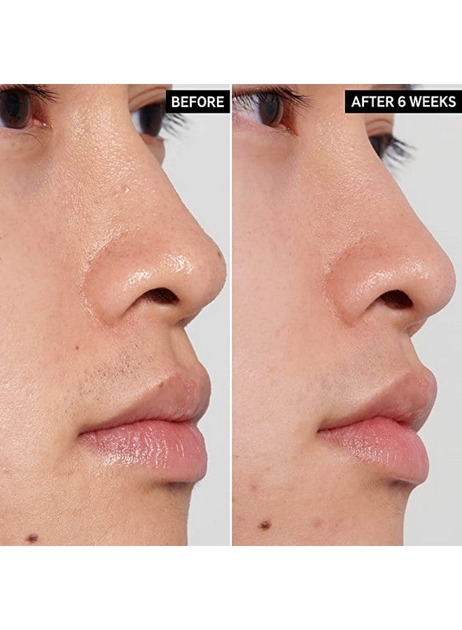 Polyhydroxy Acid Toner Gentle Chemical Pha Exfoliant For Sensitive Skin Helps Moisturize And Soothe Skin Healthylooking Skin Texture 3.38 Fl Oz