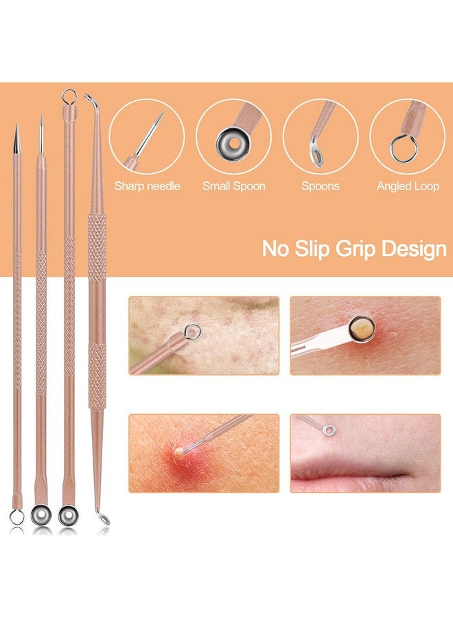Pimple Popper Tool Kit Menoly 10 Pcs Blackhead Remover Comedone Extractor Acne Removal Kit For Blemish Whitehead Poppingzit Removing For Nose Face Tools With A Leather Bag (Rose Gold)