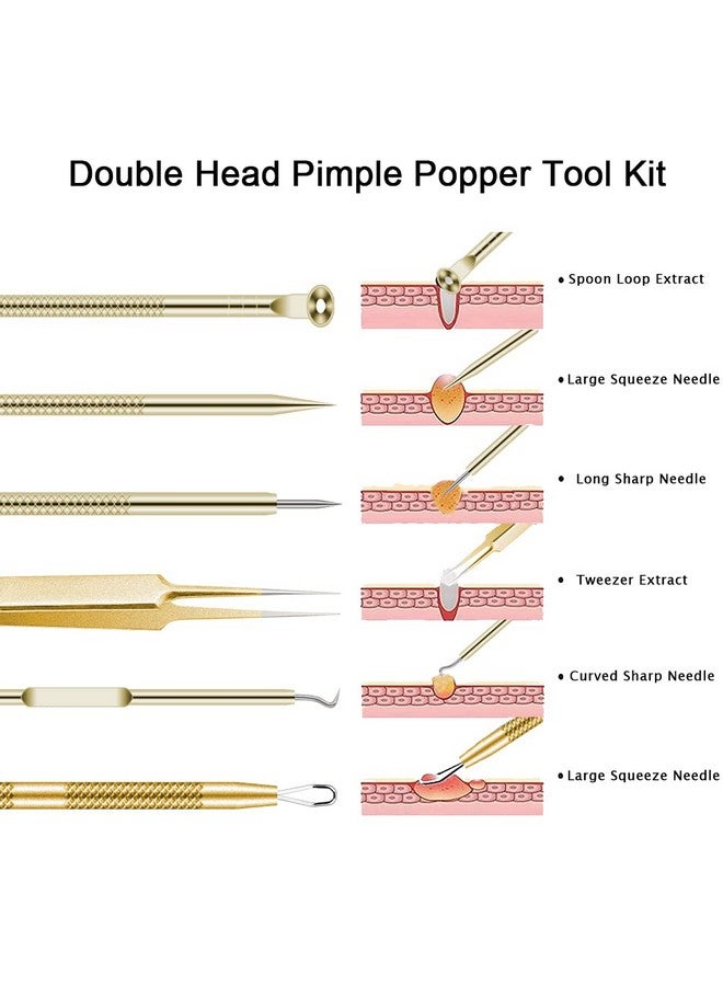 Pimple Popper Tool Kit 6 Pcs Blackhead Remover Acne Needle Tools Set Removing Treatment Comedone Whitehead Popping Zit For Nose Face Skin Blemish Extractor Tool Gold