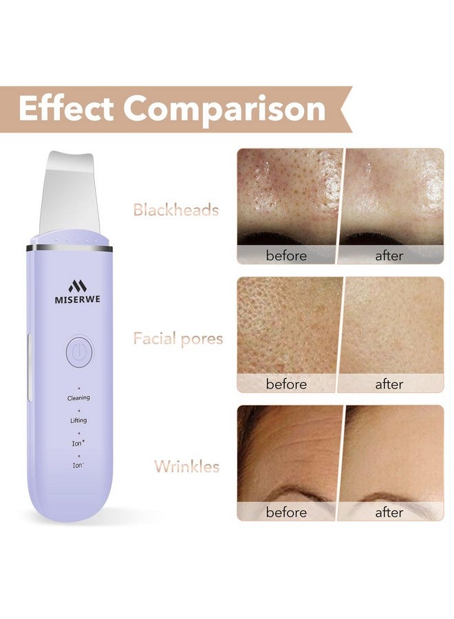 Skin Scrubber Face Skin Spatula Facial Scrubber Spatula For Deep Cleansing Blackhead Remover Pore Cleaner With 4 Modes (Purple)