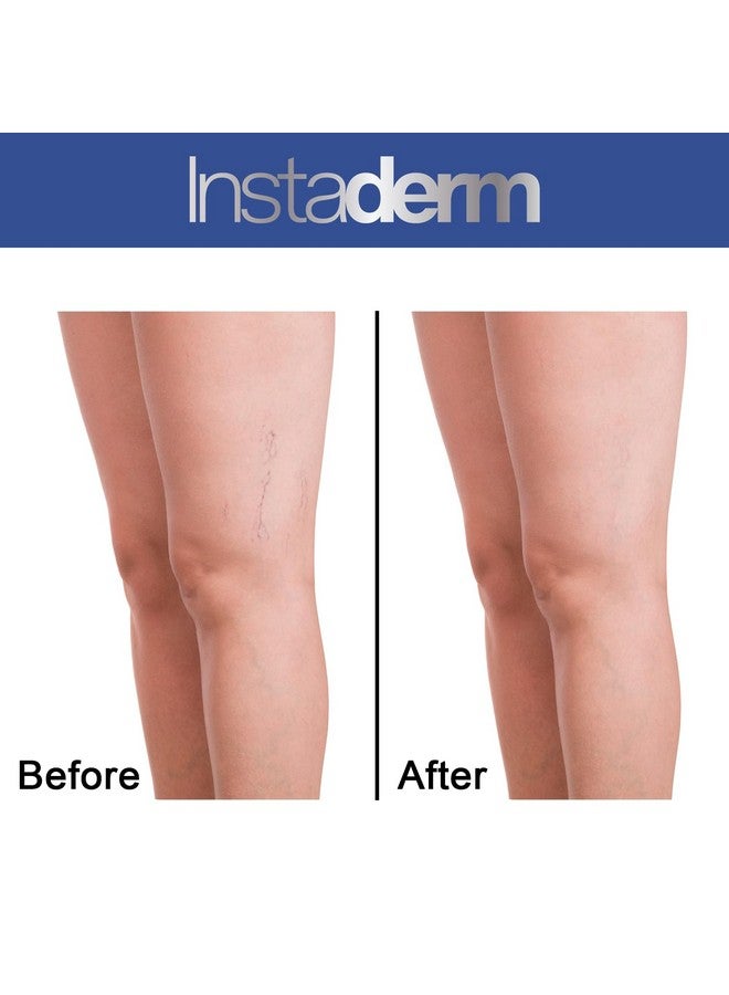 Vitamin K Cream Bruise Healing Formula With Arnica. Dark Spot Moisturizer For Bruising Spider Veins & Broken Capillaries. Repair Under Eye Dark Circles & Puffiness.