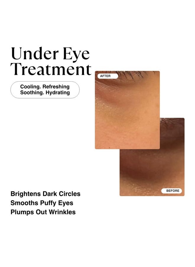 Korean Vitamin C Eye Cream For Dark Circles And Puffiness Bags Wrinkles Hydrating Energizing Brightening Under Eye Cream Anti Aging Puffy Eyes Treatment Caffeine Peptides Vitamin E