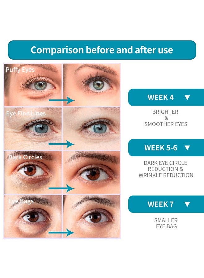 Eye Cream For Wrinkles Antiaging Eye Cream With Hyaluronic Acid Reduce Fine Lines Firm Eye Skin Puffy Eyes And Dark Circles Treatments