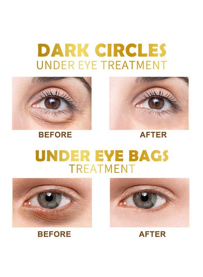 Under Eye Patches 30 Pairs Gold Eye Mask Eye Gel Pads With Collagen Treatment For Reducing Dark Circles Lighten Wrinkles Antiaging Moisturizing Fine Lines Eye Bags Puffiness For Women Men