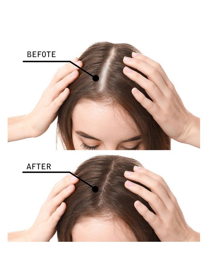 Hair Fibers For Thinning Hair For Women Black 27.5G Hair Building Fibers Instantly Conceals Hair Loss Revitalize Your Hair Unlock Thicker Fuller Tresses