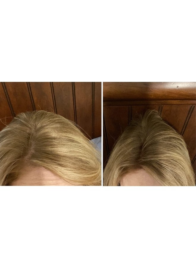 Hair Loss Concealer. Allnatural Plantbased Hair Building Fiber. Covers Bald Spot And Thinning Hair. Makes Thin Hair Look 10X Fuller Instantly (30G 90Day Supply). Natural Blonde