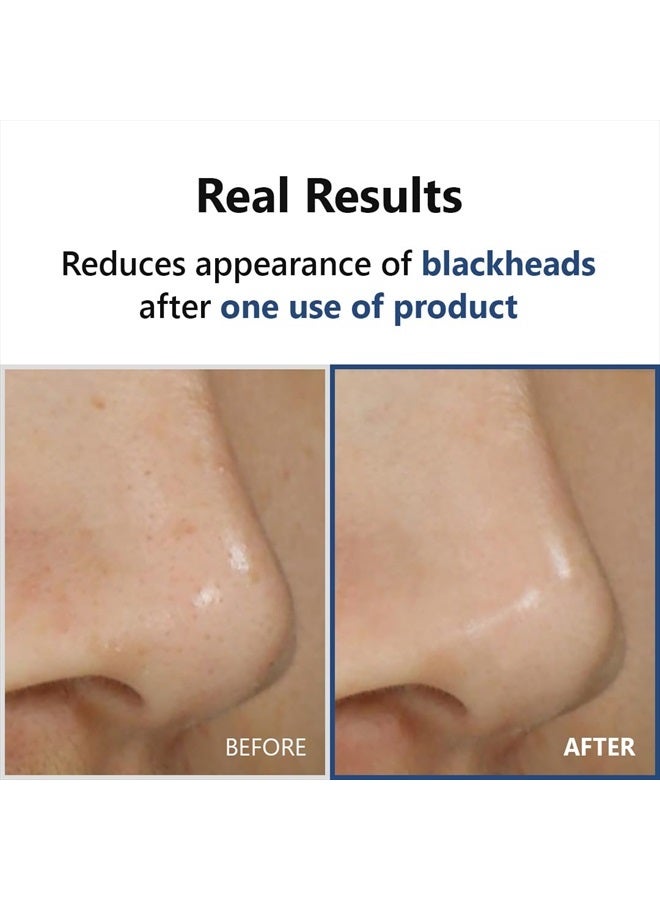 Hyper Acid 4, AHA BHA PHA LHA 30 Serum, 20ml