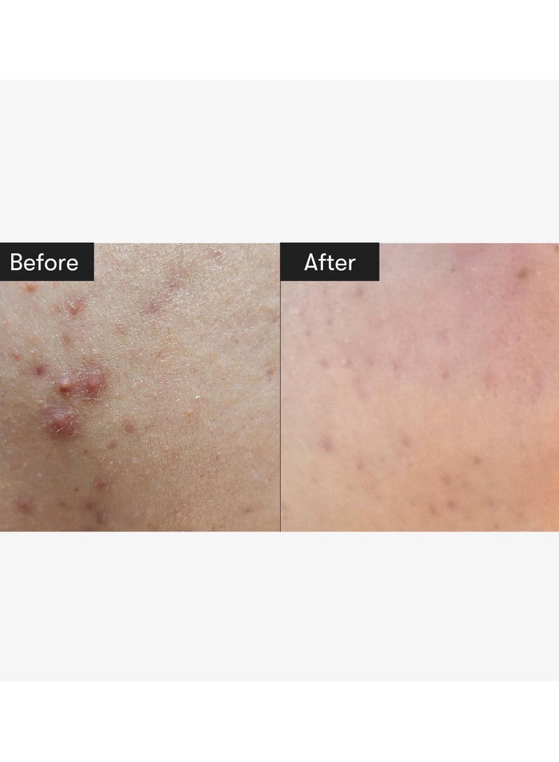 VT REEDLE SHOT 100 50ml