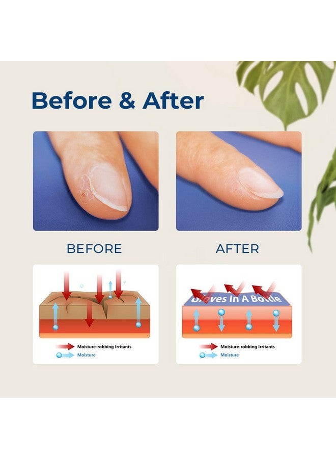 Shielding Lotion Relief For Eczema And Psoriasis 3.4 Ounces (Pack Of 2)