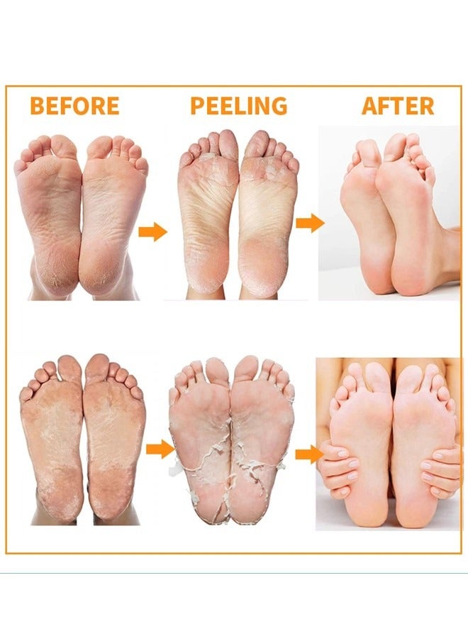 4 Pieces Foot Peeling and Exfoliating Mask, Dead Skin Removing Sock - Rose, Avocado, Orange, Peach
