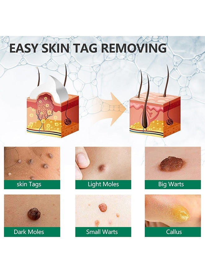 Skin Tag Remover Cream,Fast And Effective Skin Tag Remover Cream And Painless Natural Formula, Smoothes Skin Gentle Fast Acting Gel Wart Removal For Plantar Wart Flat Warts And Corns, 100 % Natural He