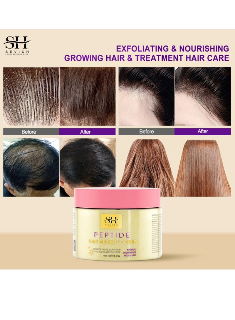 150ml Peptide Hair Growth Scrub Promote Hair Growth Control Oil and Deep Cleanse Scalp Natural Ingredient Mild and Safe Repair Damaged Cortex Regrow Scalp Hair Follicles and Cleanses