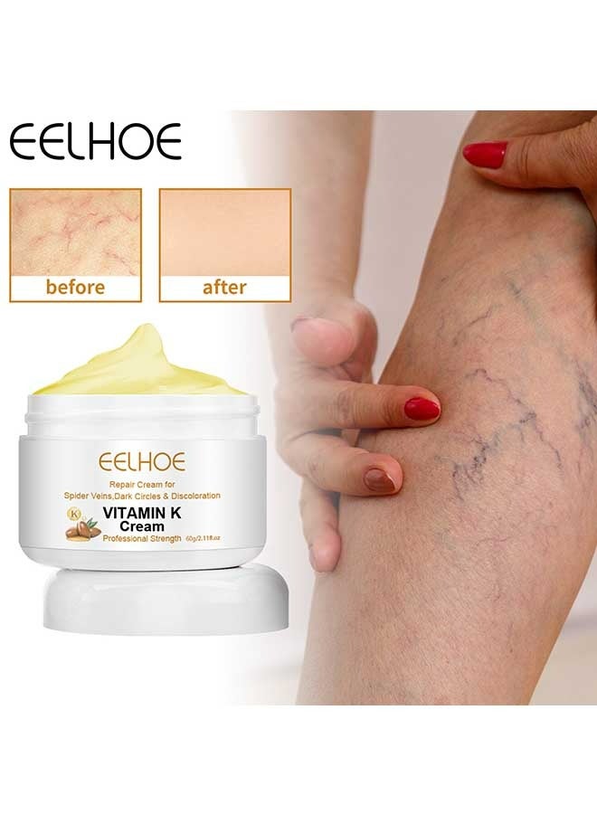 Vitamin K Varicose Veins Cream, Soothing Leg Cream, Varicose and Spider Veins Treatment Cream, Improve Blood Circulation, Fast Relieve Swelling Pain 60g