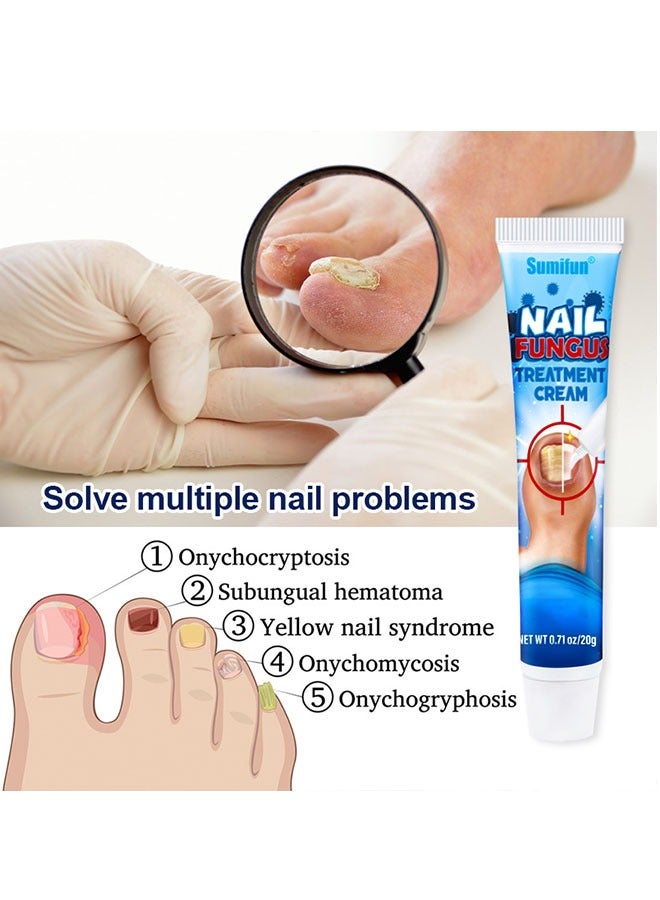 Nail Fungus Treatment Cream 20g, Bad Nail Care Ointment, Nail Fungus Treatment, Nail Growth and Repair, Nail Treatment Repair Cream