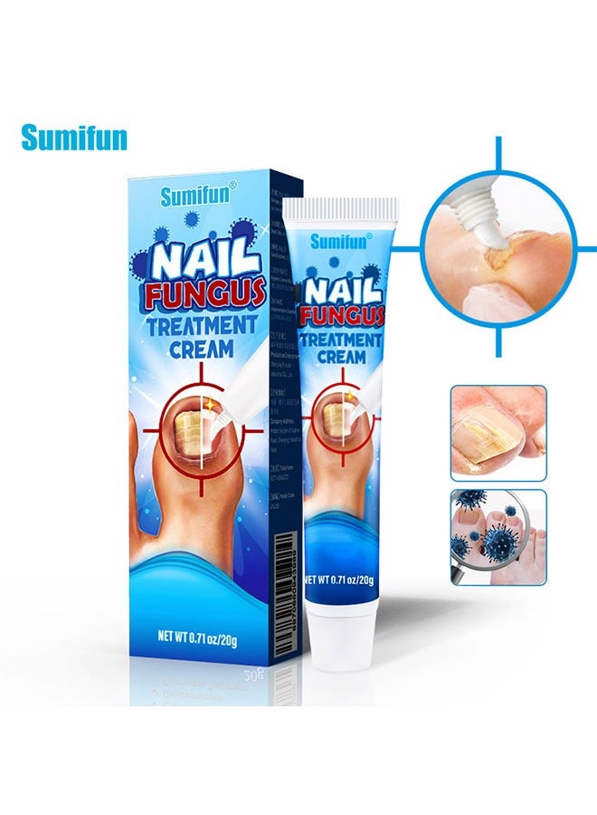 Nail Fungus Treatment Cream 20g, Bad Nail Care Ointment, Nail Fungus Treatment, Nail Growth and Repair, Nail Treatment Repair Cream