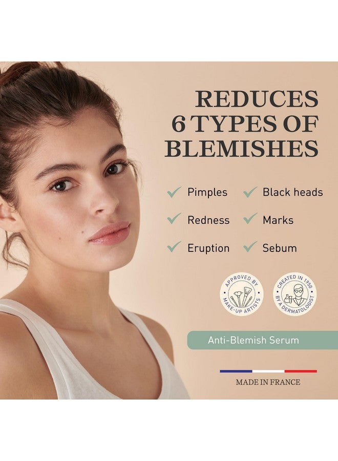 Antiblemish Face Serum Anti Pimples & Black Heads Treatment For Oily To Combination Skin 1.01 Fl Oz