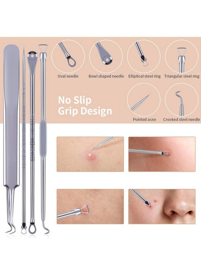 Backhead Remover 4Pcs Professional Spot Pimple Popper Tool Kit Comedone Extractor Tweezers For Remove Zit Acne With Case (Silver)