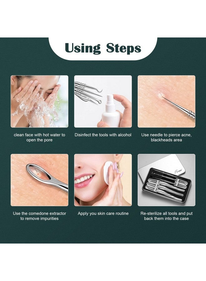Blackhead And Acne Extractor Kit Professional Pimple Popper Tool Kit Acne Tweezers And Blackhead Remover Tools For Face 6 Pcs Surgical Extractor Pimple Popping Tools