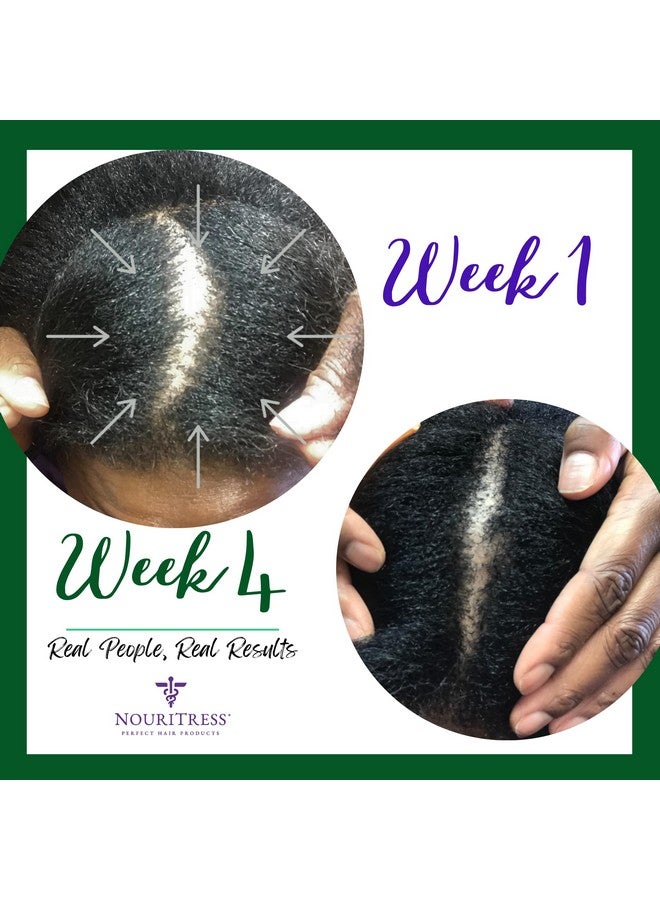 Perfect Hair Vitamins Plus 60 Tabs Hair Growth Supplements Dht Blocker Proprietary Formula Professional Salon Strength 1 Month Supply Dermatologist Recommended