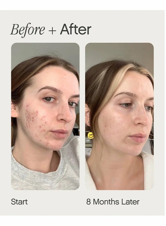 Brightening & Clearing Serum For Uneven Skin Tone - Mini Faded Serum for Dark Spots