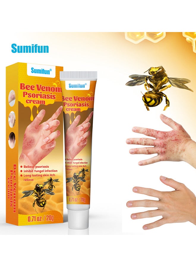 Bee Venom Psoriasis Cream, New Zealand Bee Venom Professional Psoriasis Cream For Itchy Skin Fast Relief Cream For Face And Body, Soothing And Moisturizing Psoriasis Cream 20G