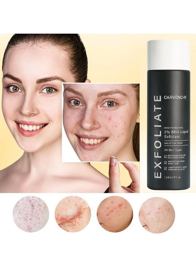 Skin Perfecting 2% BHA Liquid Salicylic Acid Exfoliant, Gentle Facial Exfoliator For Blackheads, Large Pores, Wrinkles And Fine Lines, Travel Size, 118ML