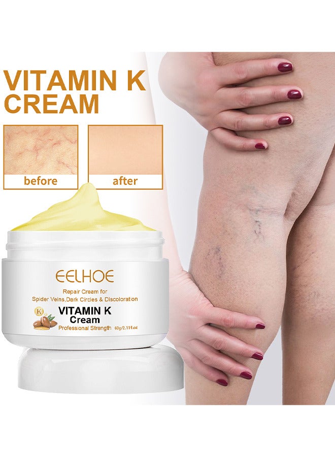 Vitamin K Varicose Veins Cream, Soothing Leg Cream, Varicose And Spider Veins Treatment Cream, Improve Blood Circulation, Fast Relieve Swelling Pain 60G