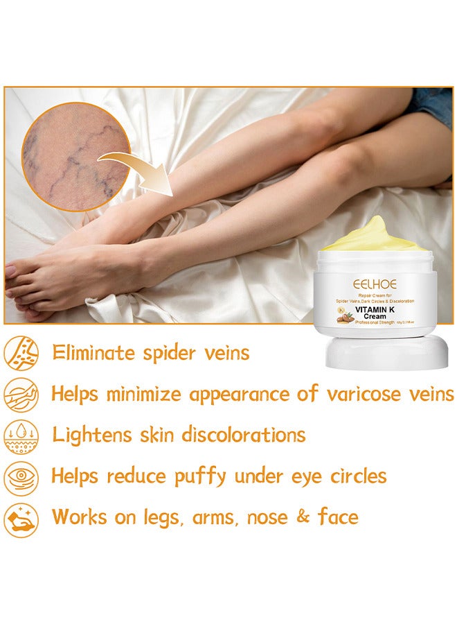 Vitamin K Varicose Veins Cream, Soothing Leg Cream, Varicose And Spider Veins Treatment Cream, Improve Blood Circulation, Fast Relieve Swelling Pain 60G