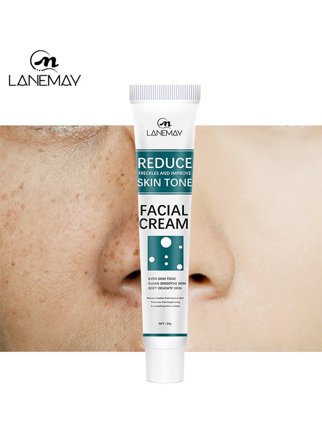 Reduce Freckles And Improve Skin Tone Facial Cream, Dark Spot Remover For Face Peeling Skin Whitening Freckle Cream Pigmentation Treatment Sun Spots Age Spots Blemish Remover Lightening Cream