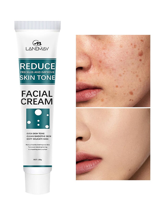Reduce Freckles And Improve Skin Tone Facial Cream, Dark Spot Remover For Face Peeling Skin Whitening Freckle Cream Pigmentation Treatment Sun Spots Age Spots Blemish Remover Lightening Cream