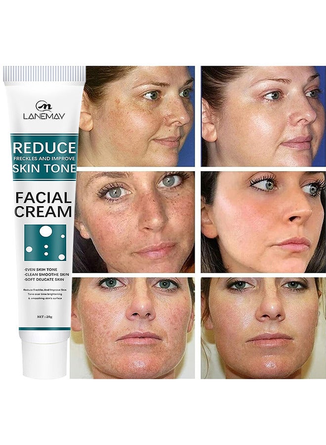 Reduce Freckles And Improve Skin Tone Facial Cream, Dark Spot Remover For Face Peeling Skin Whitening Freckle Cream Pigmentation Treatment Sun Spots Age Spots Blemish Remover Lightening Cream