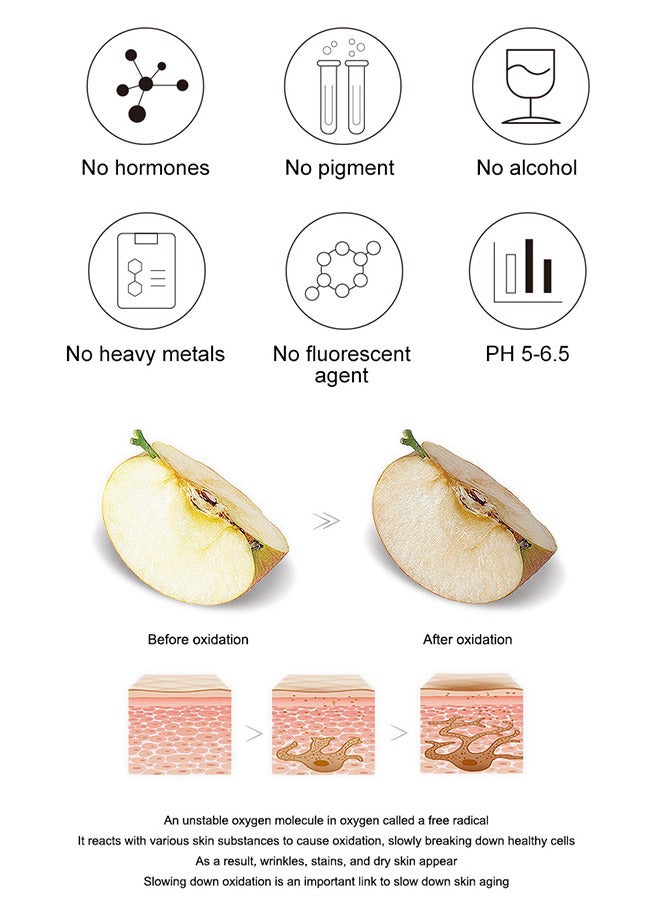 Reduce Freckles And Improve Skin Tone Facial Cream, Dark Spot Remover For Face Peeling Skin Whitening Freckle Cream Pigmentation Treatment Sun Spots Age Spots Blemish Remover Lightening Cream