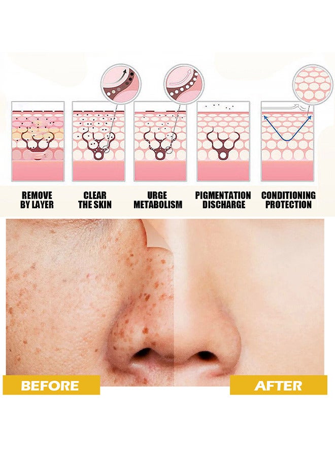 100% Turmeric Extract Facial Toner, Dark Spot Correcting Toner For Face, Reduces Hyperpigmentation, Antil Aging Linghten Spots Age Spots, Sun Spots And Improves Skin Tone, Calming And Smoothing Skin