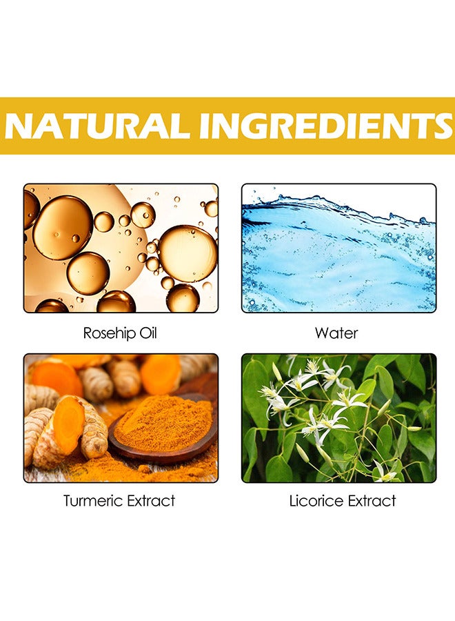 100% Turmeric Extract Facial Toner, Dark Spot Correcting Toner For Face, Reduces Hyperpigmentation, Antil Aging Linghten Spots Age Spots, Sun Spots And Improves Skin Tone, Calming And Smoothing Skin