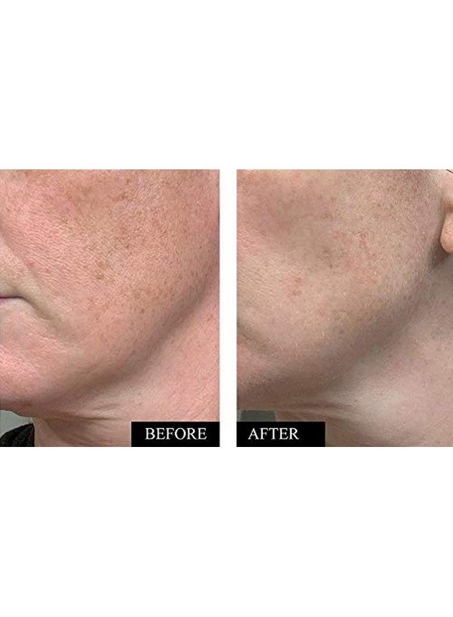 Organic Vitamin C Serum For Face With Hyaluronic Acid Best Anti Wrinkle Facial Serum To Reduce Wrinkles Dark Spots & Sun Damage Anti Aging Brightening Vitamin C Face Serum For Women & Men 1.7 Oz