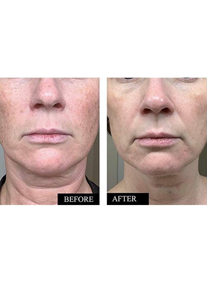 Organic Vitamin C Serum For Face With Hyaluronic Acid Best Anti Wrinkle Facial Serum To Reduce Wrinkles Dark Spots & Sun Damage Anti Aging Brightening Vitamin C Face Serum For Women & Men 1.7 Oz