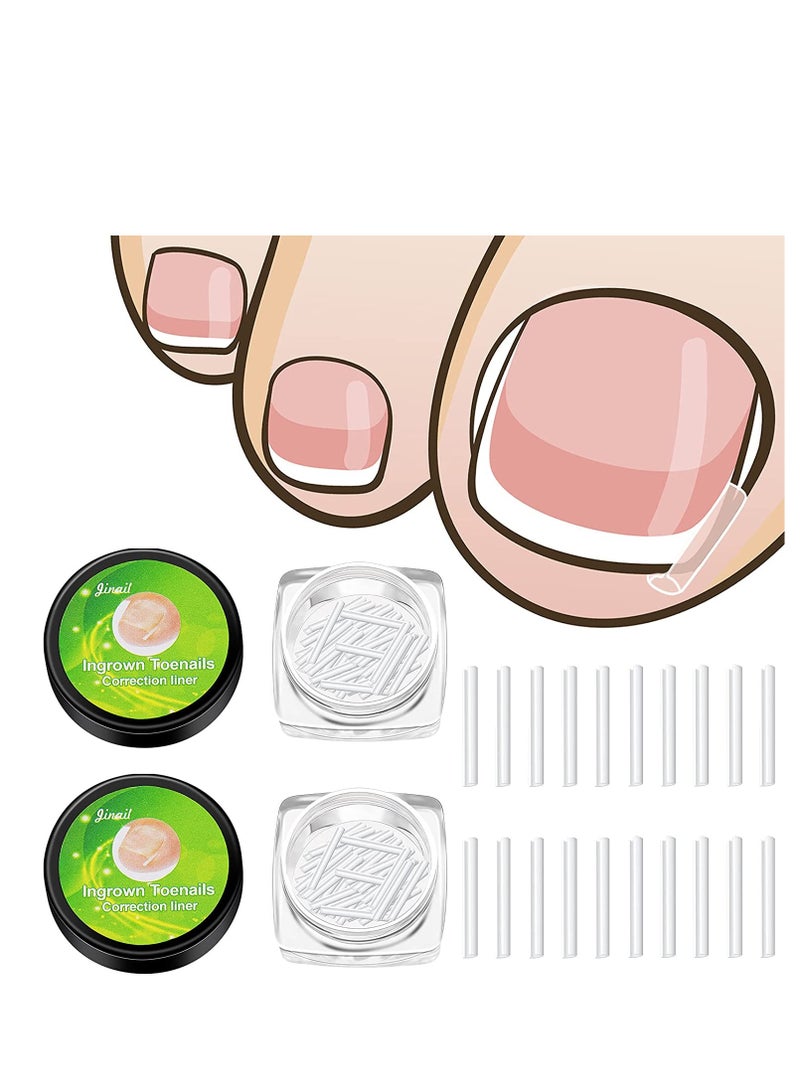Ingrown Toenail Corrector Strips Toenail Correction Patches Curved Toenails Straightening Recover Clips Thick Paronychia Pedicure Tool Toenail Straightener Strip for Men Women Foot Care 100 Pieces