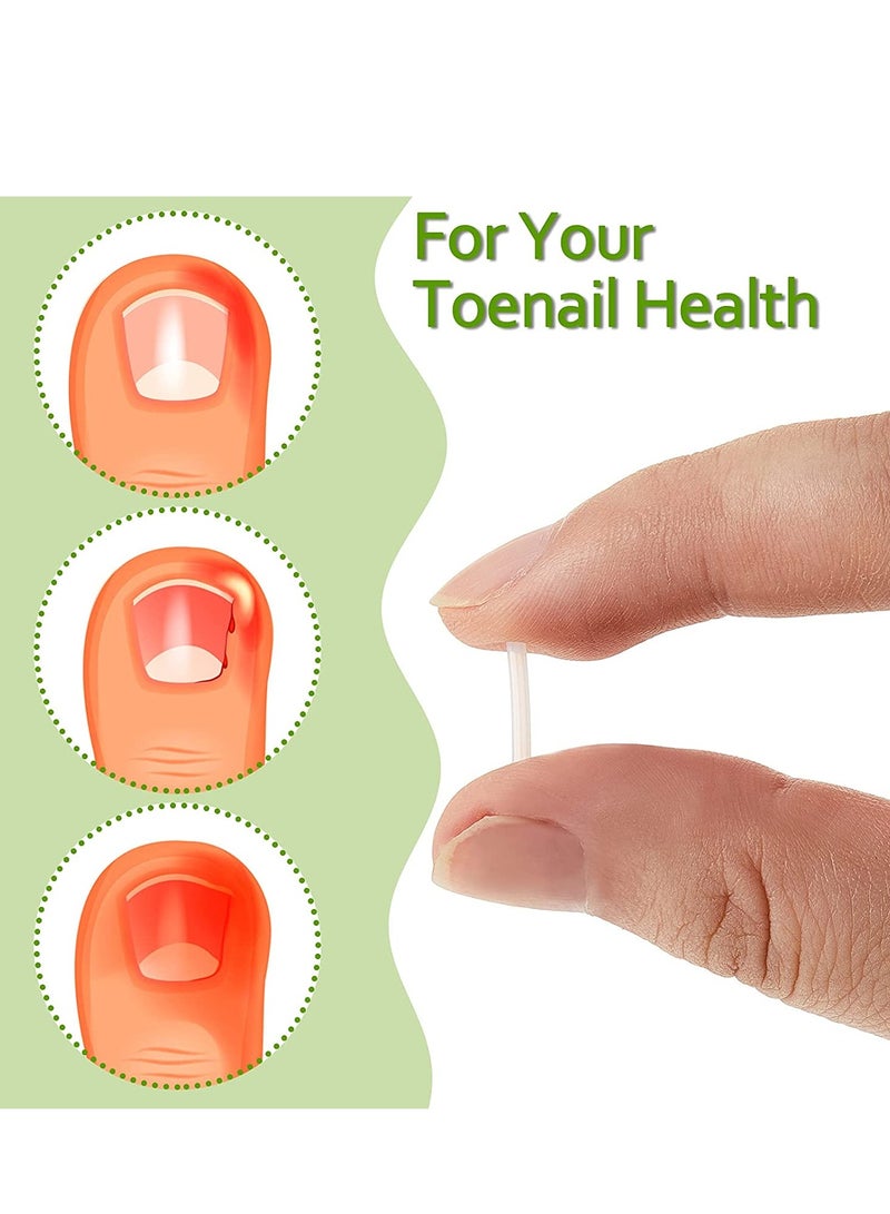 Ingrown Toenail Corrector Strips Toenail Correction Patches Curved Toenails Straightening Recover Clips Thick Paronychia Pedicure Tool Toenail Straightener Strip for Men Women Foot Care 100 Pieces