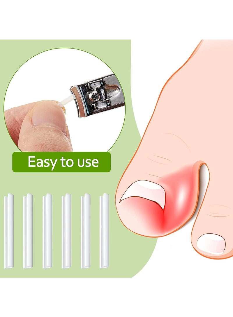 Ingrown Toenail Corrector Strips Toenail Correction Patches Curved Toenails Straightening Recover Clips Thick Paronychia Pedicure Tool Toenail Straightener Strip for Men Women Foot Care 100 Pieces