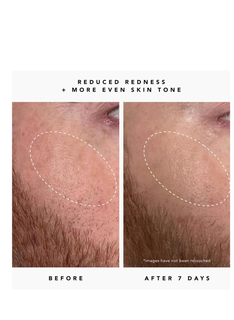 HERBIVORE Nova Brightening Serum for Face – 15% Vitamin C + Turmeric to Visibly Improve the Look of Dark Spots and Even Skin Tone, Plant-based, Vegan, Cruelty-free, 30mL /1 oz